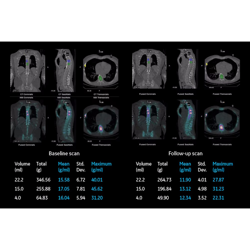 Томограф ОФЭКТ/КТ GE NM/CT 870 DR